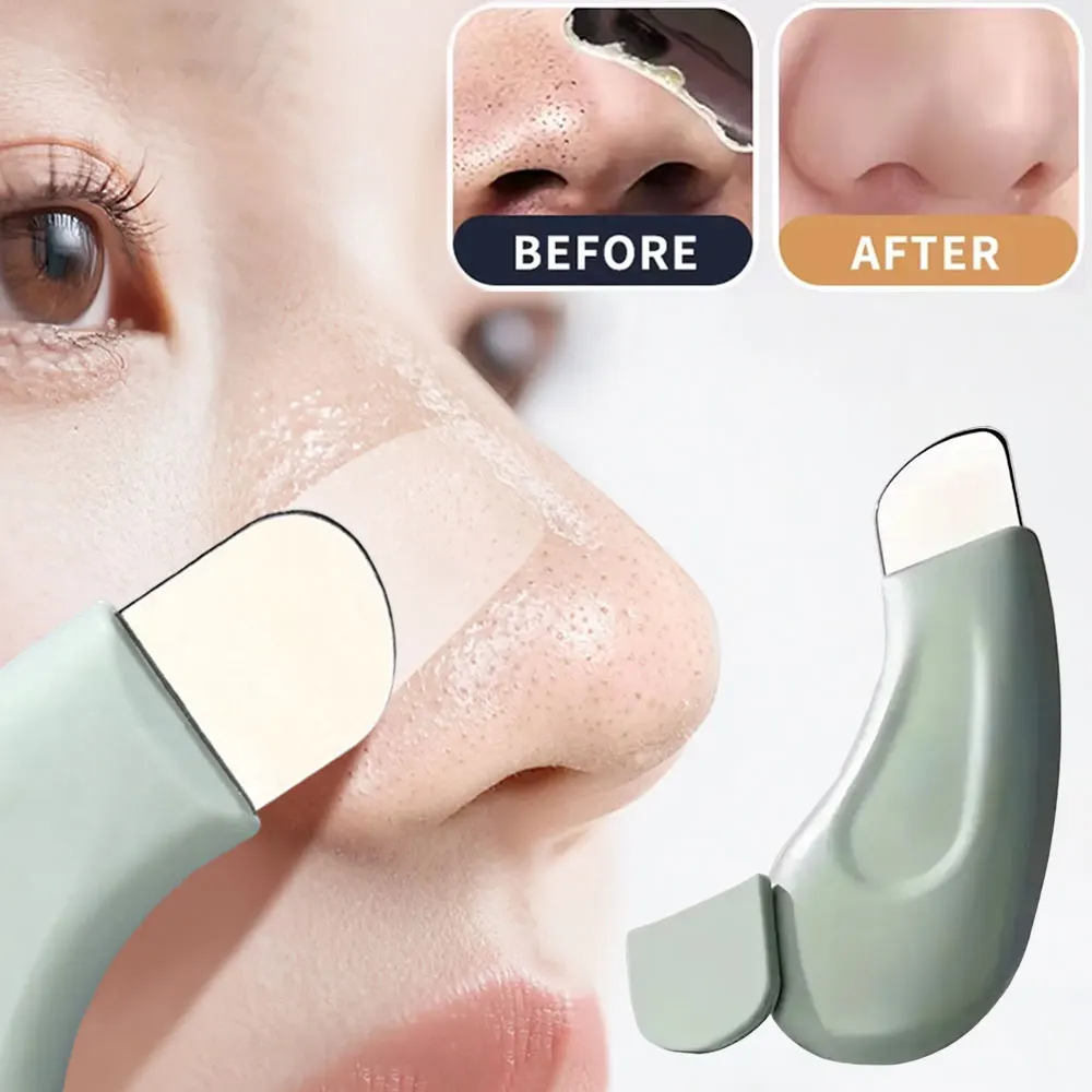 Nasal Aspirator - Ferramenta para Remoção de Cravos Faciais,